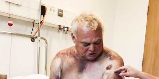 image: Brutalt angrep kan bli henlagt