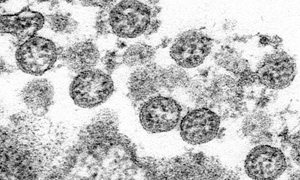 image: Hyller ny coronatest: «Game changer»