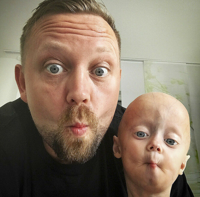 MINDRE ENN LILLESØSTER: Fem år gamle Luke veier bare i underkant av ti kilo, og er mye mindre enn lillesøster Lea - som er tre og et halvt år gammel. Foto: Media Drum World MINDRE ENN LILLESØSTER: Fem år gamle Luke veier bare i underkant av ti kilo, og er mye mindre enn lillesøster Lea - som er tre og et halvt år gammel. Foto: Media Drum World