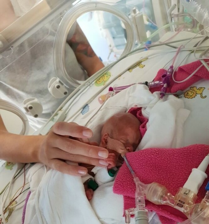 HELEN: Lille Helén inne i kuvøsen sin. Det var sårt for foreldrene å se henne slik. FOTO: Privat HELEN: Lille Helén inne i kuvøsen sin. Det var sårt for foreldrene å se henne slik. FOTO: Privat