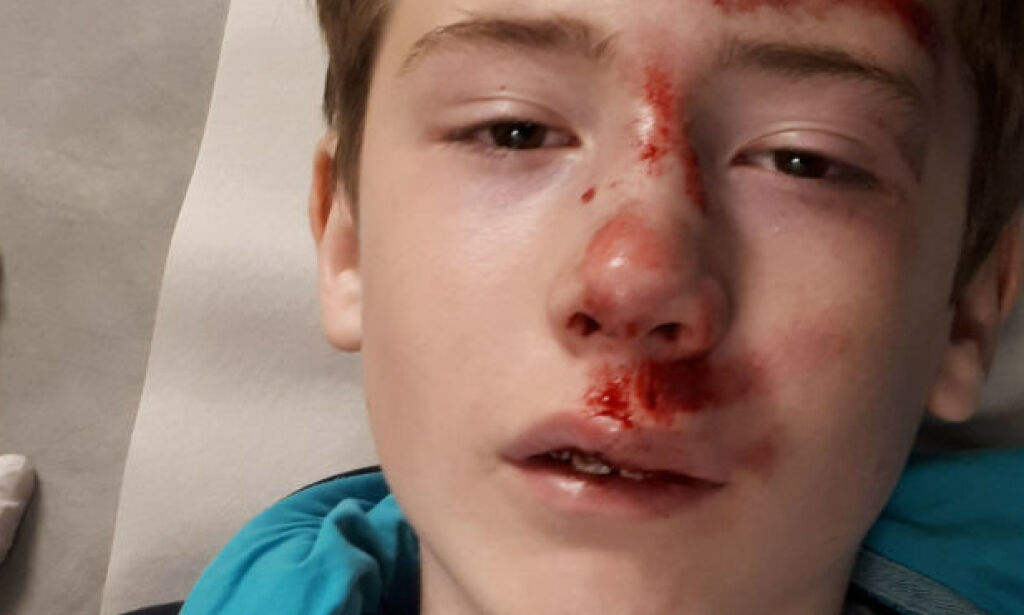image: Advarer mot livsfarlig «lek»