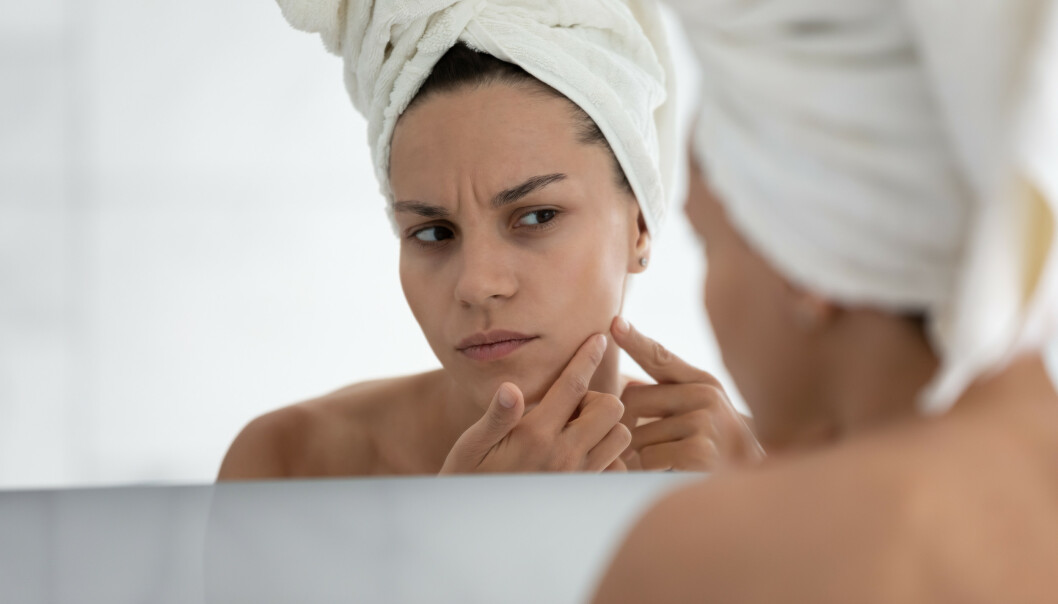 BRUK SOLKREM: Ifølge Nordal kan UV stråling forverre perioral dermatitt, og hun anbefaler på det sterkeste å bruke solkrem i sommersesongen. Foto: NTB Scanpix BRUK SOLKREM: Ifølge Nordal kan UV stråling forverre perioral dermatitt, og hun anbefaler på det sterkeste å bruke solkrem i sommersesongen. Foto: NTB Scanpix