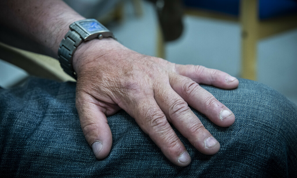 ARBEIDSULYKKE: Venstehånda til Kazimierz ble knust i en arbeidsulykke i 2018. Det var da han gradvis skulle tilbake i jobb igjen at problemene startet. Foto: Lars Eivind Bones / Dagbladet ARBEIDSULYKKE: Venstehånda til Kazimierz ble knust i en arbeidsulykke i 2018. Det var da han gradvis skulle tilbake i jobb igjen at problemene startet. Foto: Lars Eivind Bones / Dagbladet