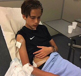 PÅ LEGEVAKTA: Johannes Handeland (13) ble stygt forslått på høyre side og måtte på legevakta etter det brutale fallet. Foto: Privat PÅ LEGEVAKTA: Johannes Handeland (13) ble stygt forslått på høyre side og måtte på legevakta etter det brutale fallet. Foto: Privat