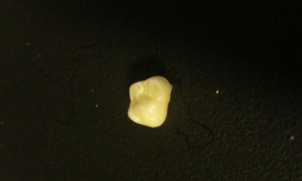 image: Fant denne tanna i pasta-middagen