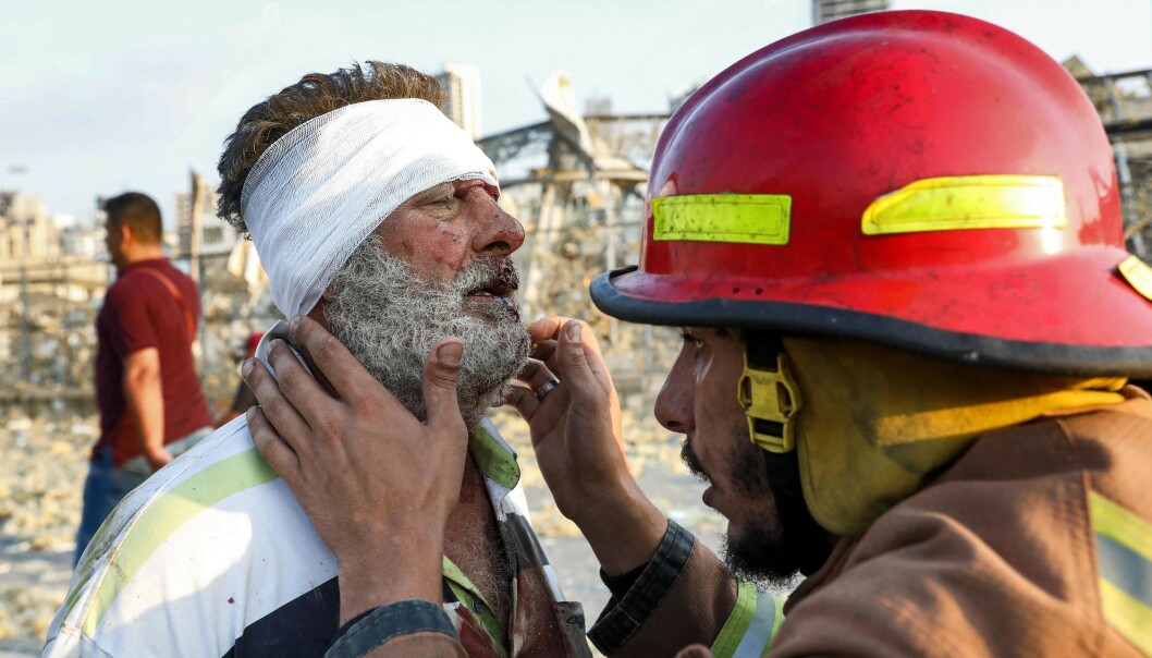<strong>SKADD:</strong> En mann jekkes av brannmannskapene i nærheten av eksplosjonsstedet. Foto: AFP <strong>SKADD:</strong> En mann jekkes av brannmannskapene i nærheten av eksplosjonsstedet. Foto: AFP