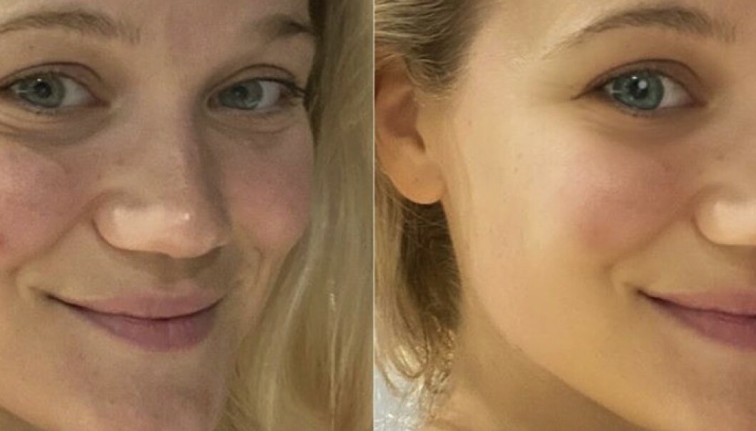 - Skremmende at man kan endre slik på utseende - Skremmende at man kan endre slik på utseende