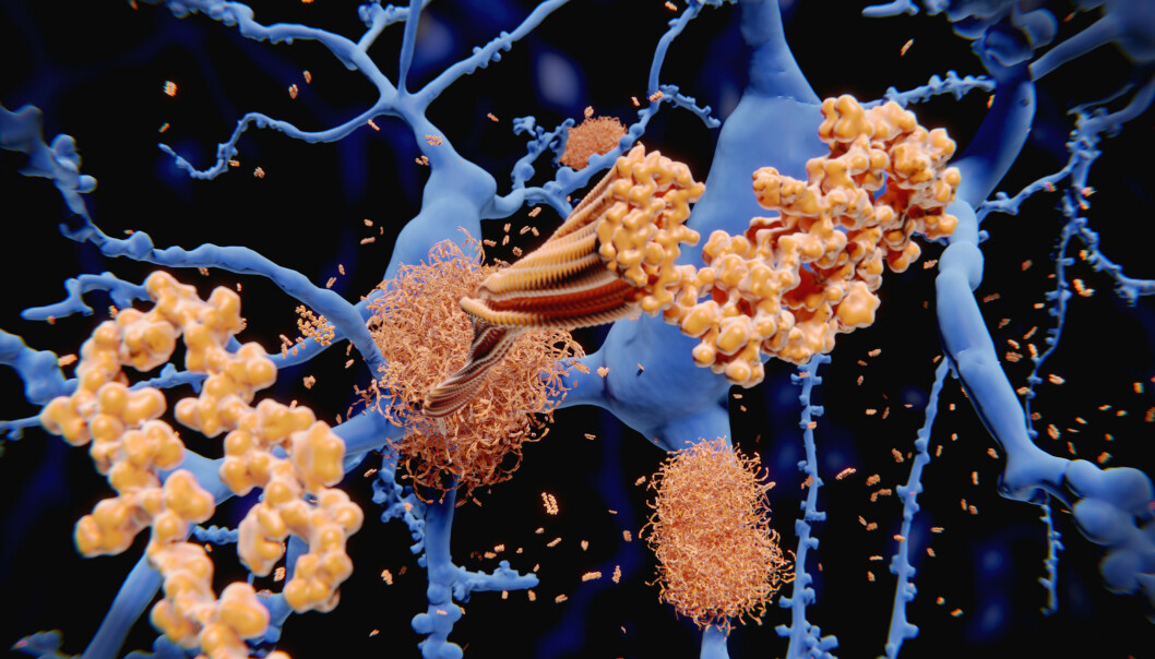Mulig nytt medikament mot Alzheimer Mulig nytt medikament mot Alzheimer