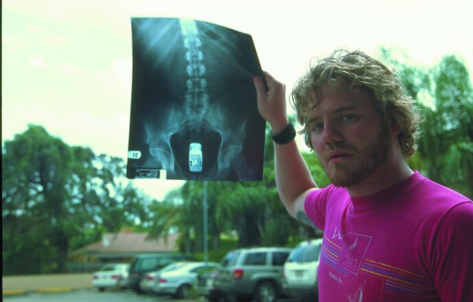 <strong>LEKEBIL:</strong> Et av Ryan Dunns mest kjente stunt var da han puttet en lekebil inn i rektum. Foto: NTB Scanpix <strong>LEKEBIL:</strong> Et av Ryan Dunns mest kjente stunt var da han puttet en lekebil inn i rektum. Foto: NTB Scanpix