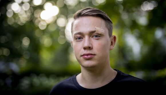 <strong>- VANLIG:</strong> Selv om han aldri før er blitt slått ned, forteller Edvin Eriksen at de aller fleste skeive vennene hans i Oslo har opplevd noe liknende før. Foto: Bjørn Langsem / Dagbladet <strong>- VANLIG:</strong> Selv om han aldri før er blitt slått ned, forteller Edvin Eriksen at de aller fleste skeive vennene hans i Oslo har opplevd noe liknende før. Foto: Bjørn Langsem / Dagbladet