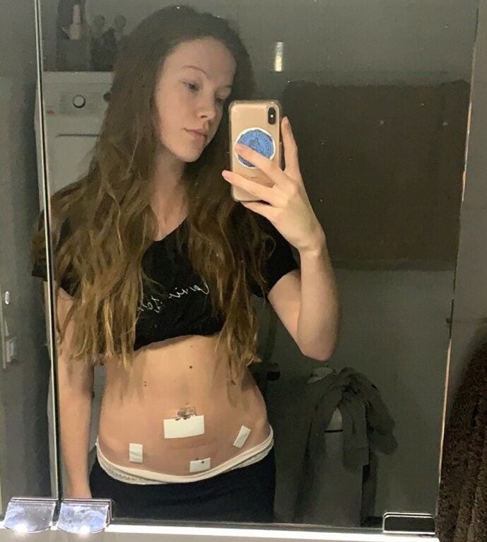 <strong>FØRSTE TEGN:</strong> I tenårene merket Martine at kroppen ikke fungerte som den skulle. Hun hadde vondt når hun ikke hadde menstruasjon. <strong>FØRSTE TEGN:</strong> I tenårene merket Martine at kroppen ikke fungerte som den skulle. Hun hadde vondt når hun ikke hadde menstruasjon.