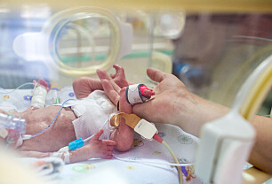 Prematur fødsel: Dette skjer ved for tidlig fødsel