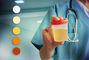 Hva er normal farge på urin?