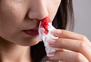 Legens råd: Ikke gjør dette ved neseblødning!